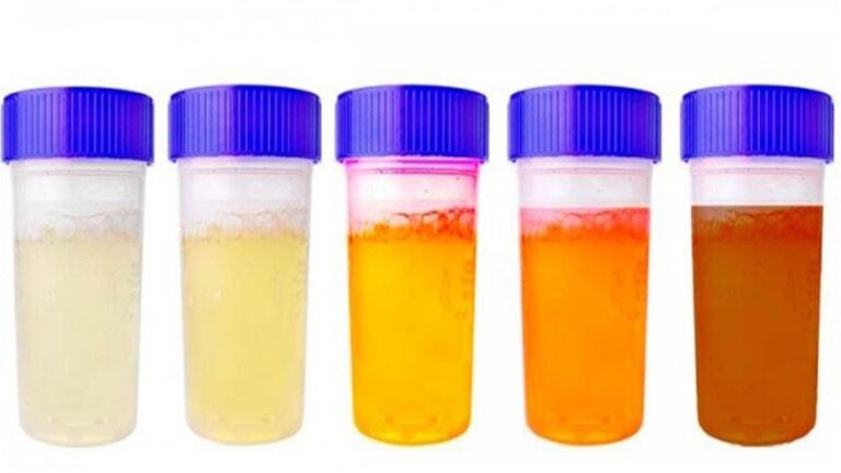 Cette astuce simple révèle ce que la couleur de votre urine dit sur votre santé…