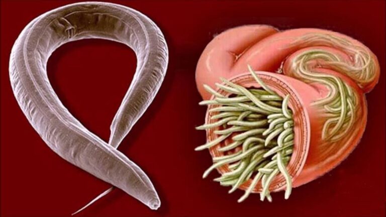 Cette astuce surprenante pour éliminer les parasites transformera votre jardin…