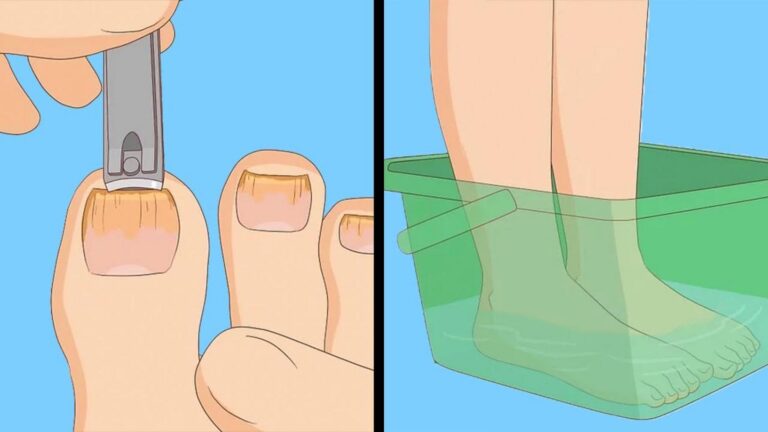 Cette astuce simple fait disparaître les ongles rongés… vous ne le regretterez pas !