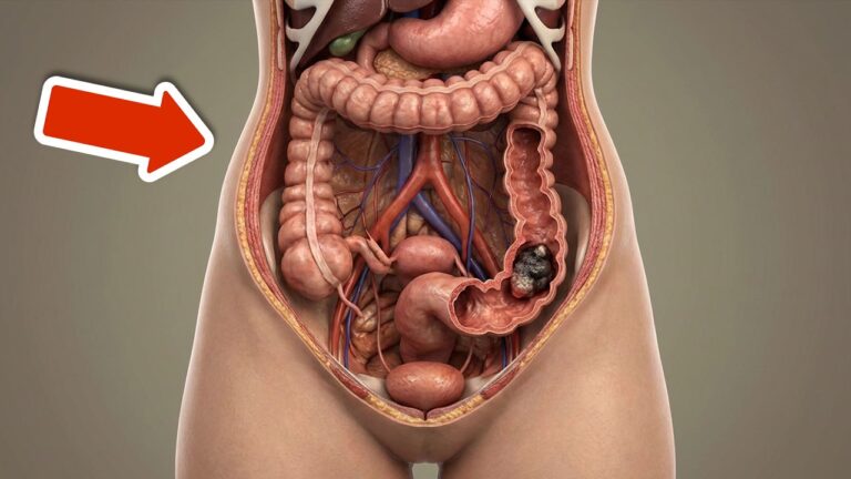 Les 5 symptômes de cancer du côlon à ne pas ignorer pour votre santé !