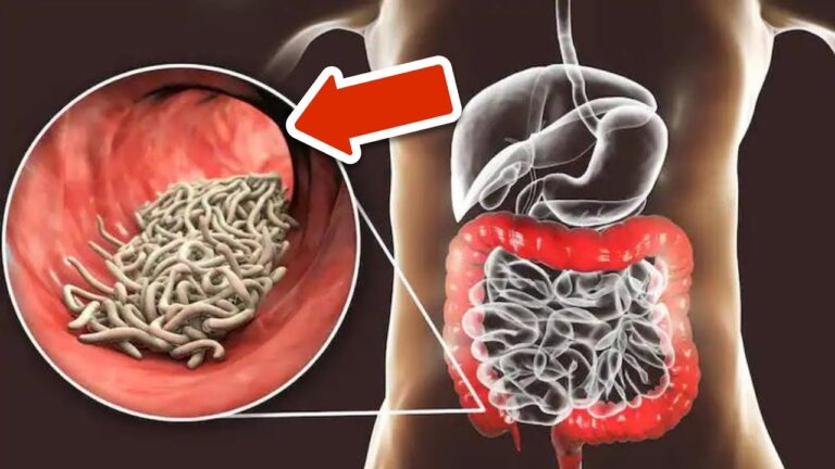 2 cuillères pour éliminer 100% des parasites de votre corps naturellement !
