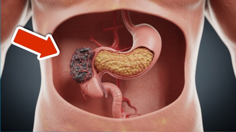 7 signes précoces de cancer que peu de gens détectent : soyez vigilant !