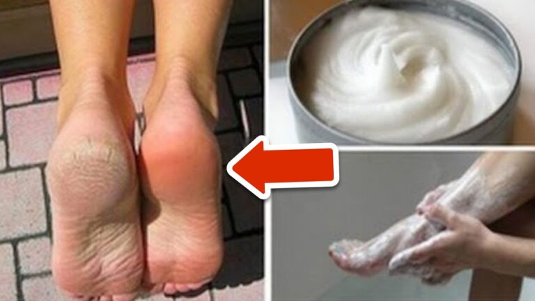 Éliminez les mycoses et cors des pieds avec ces 3 remèdes maison faciles !