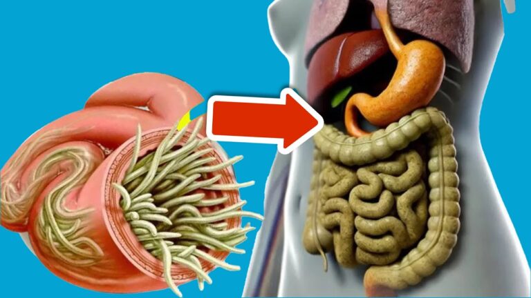 Éliminez 5 parasites de votre intestin grâce à ces aliments simples et rapides !