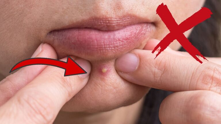5 lieux surprenants où éviter de percer un bouton pour une peau parfaite !