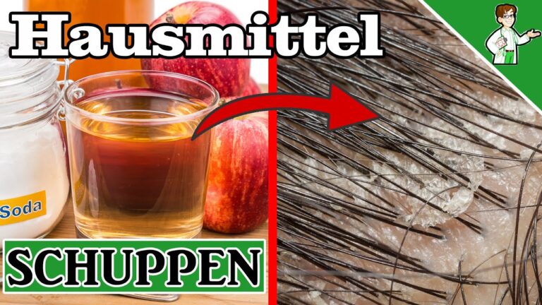 7 astuces naturelles pour éliminer les pellicules et retrouver des cheveux sains !