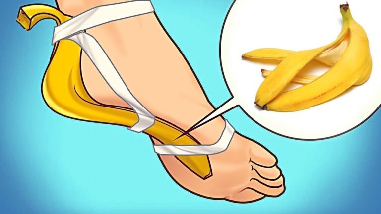 5 avantages surprenants des bananes que vous ne connaissez pas encore !