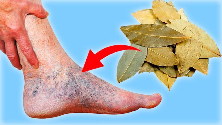 3 aliments essentiels pour dire adieu aux varices et douleurs !
