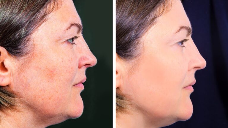 Éliminez 5 taches de peau avec ces astuces naturelles simples et efficaces
